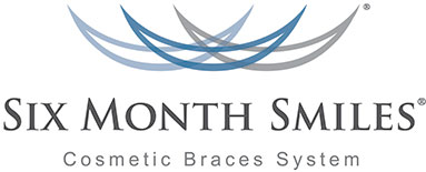 six month smiles cosmetic braces system