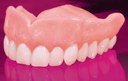 full upper dentures